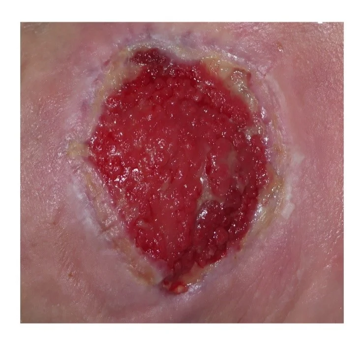 Un primer plano de una herida