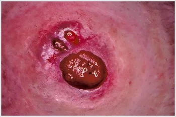 Eine Nahaufnahme des Fußes einer Person