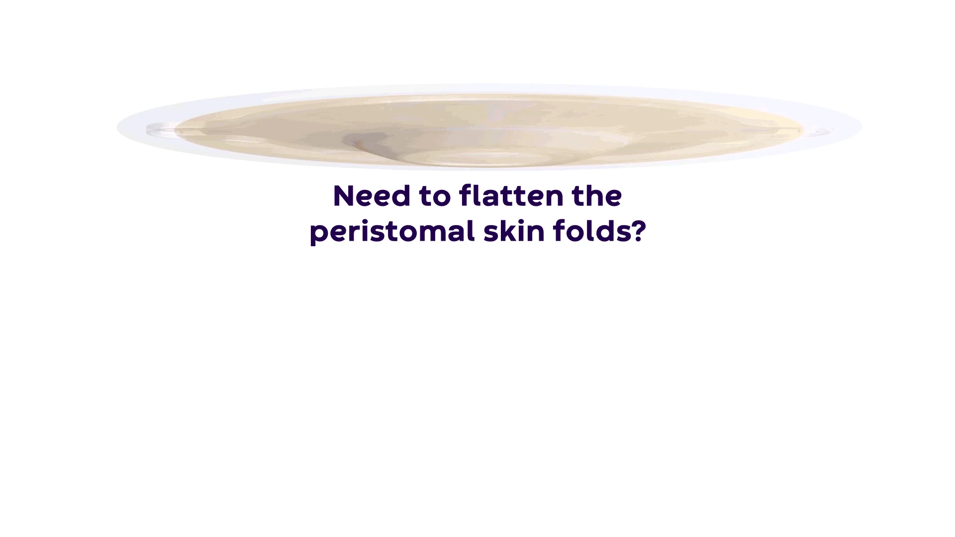 A video explaining peripheral tension to flatten peristomal skin folds for a reliable ostomy seal.